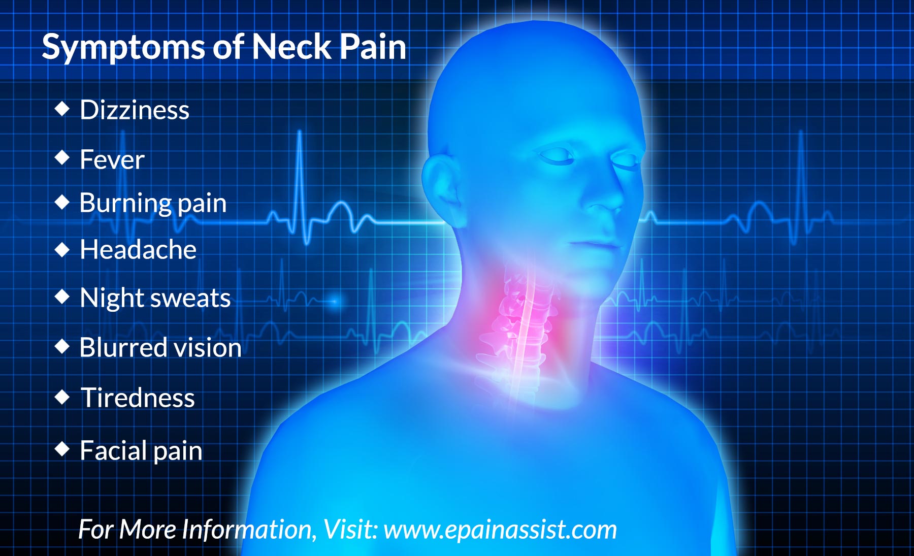 662c078a-baaf-4e99-997b-1120ae4d7671symptoms-of-neck-pain-or-cervicalgia